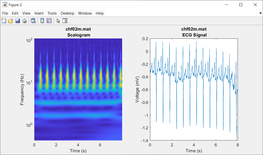 CWT Feature Extraction