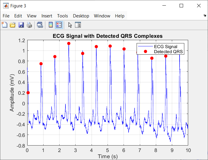 Signal Component Review